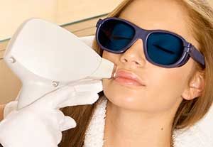 photoepilation photoepilation